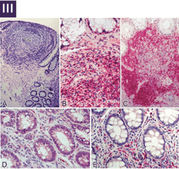 Figure 4. Panel III, Immunohistochemical characterization of the immune effector and inductive sites in the rectal biopsies.