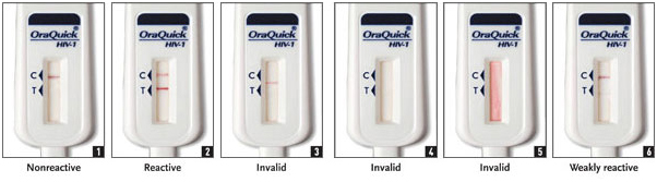 Figure 3. Reading and Interpreting an OraQuick Rapid Advance Antibody Test....